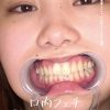 口内フェチ ～歯・口内・舌ベロ・涎・のどちんこ観察～ 篠原りこ